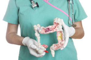 Female nurse holding anatomical model of human colon with pathologies. The model shows appendicitis, cancer, Crohn’s disease, spastic colon, ulcerative colitis, polyps, diverticulosis, diverticulitis, bacterial infection and adhesions.