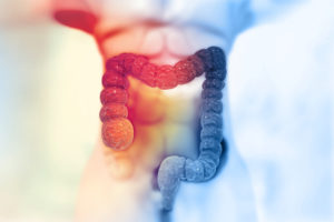 Graphic of the human colon