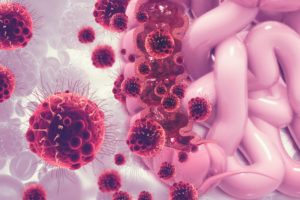 Colon cancer attacking cell.