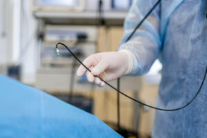 Manipulator digital endoscope for diagnostics of hollow organs, colonoscopy, gastroscopy. Selective focus on doctor`s hands