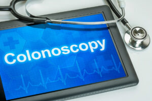 Colon cancer Screening - Colonoscopy