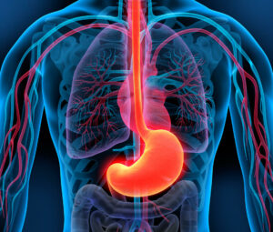 An illustrated image of the human digestive system, focusing on the stomach and esophagus.